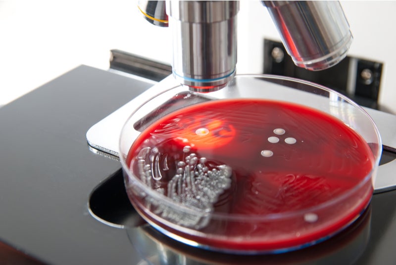 US sees decline in new hospital-onset staphylococcus aureus infections