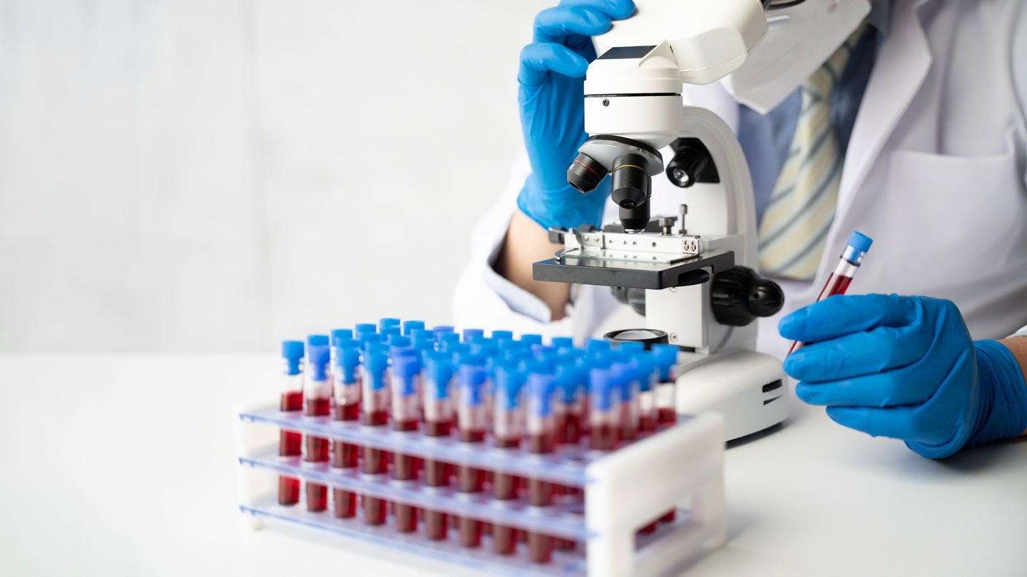 First patient dosed in Onchilles’ Phase I/II trial of N17350