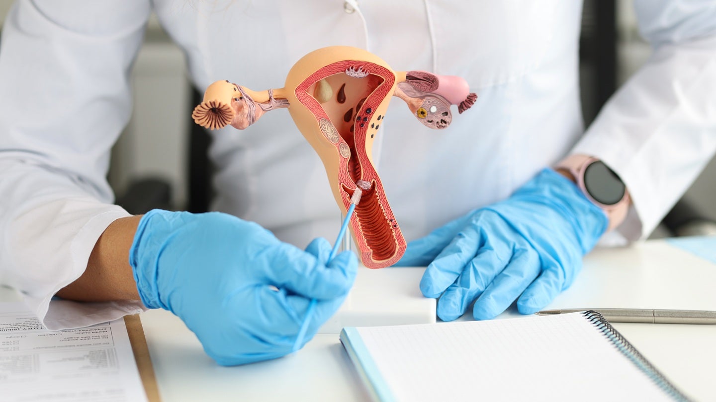 Claria Medical secures FDA De Novo classification for hysterectomy device 