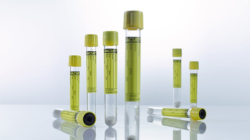 VACUETTE Urine CCM Tube