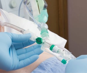 Intersurgical has introduced a new range of adult 24 hour and 72 hour closed suction systems for ventilated patients.