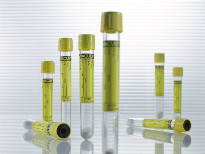 Urine Sample Tubes